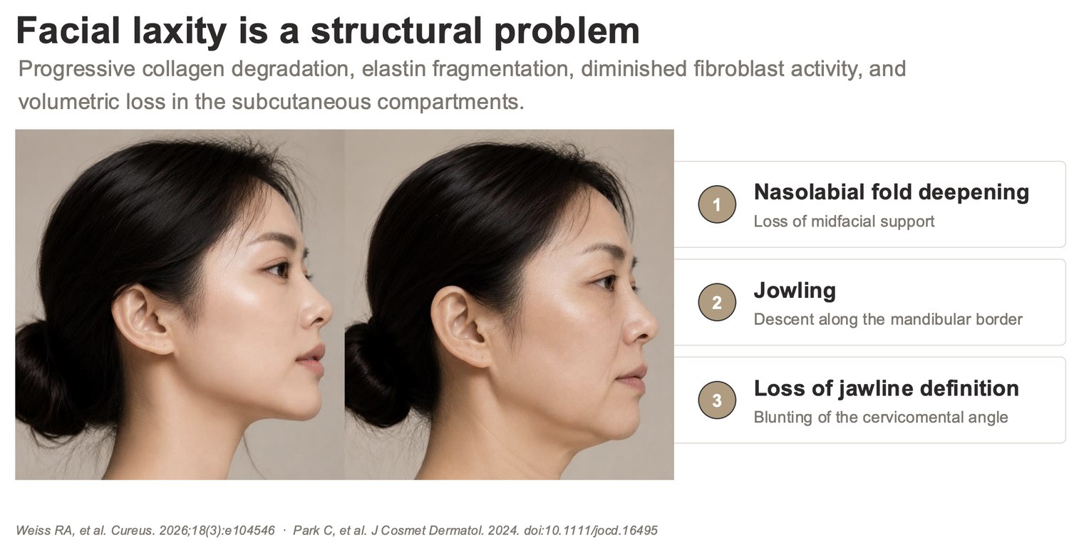Presentation slide: facial laxity as a structural problem of collagen degradation, elastin fragmentation and volumetric loss
