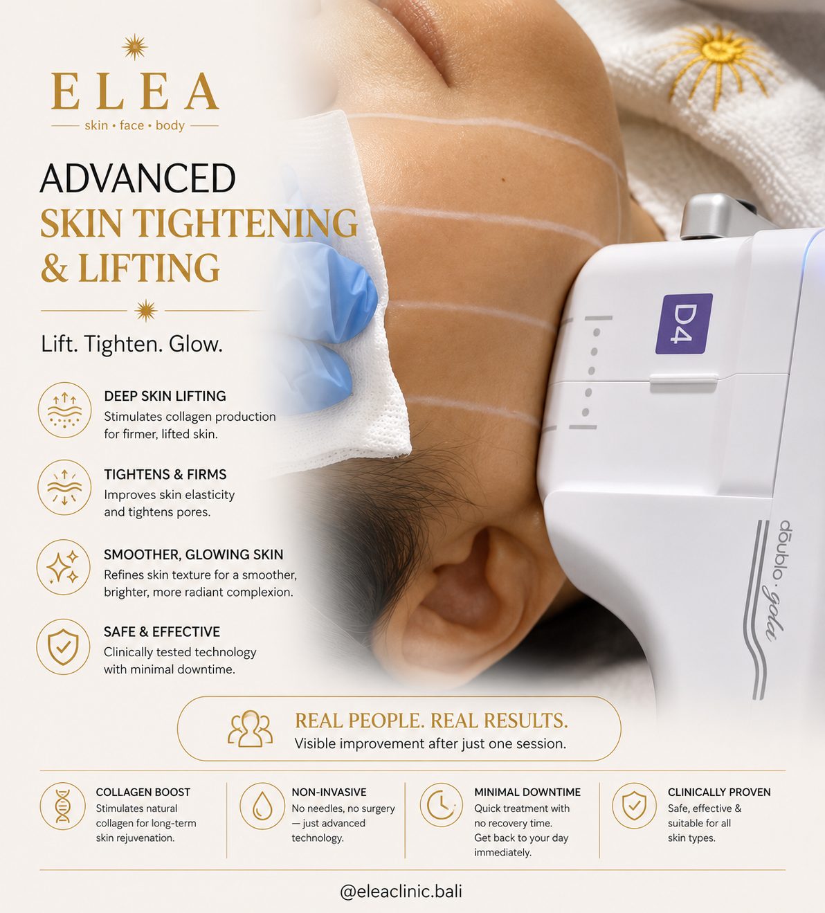 Non-surgical body skin tightening at Elea Clinic Bali