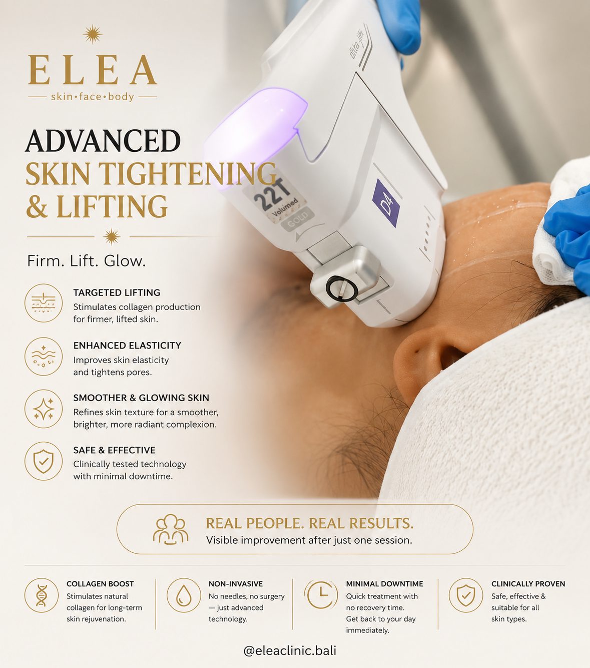Non-surgical facial skin tightening and lifting at Elea Clinic Bali