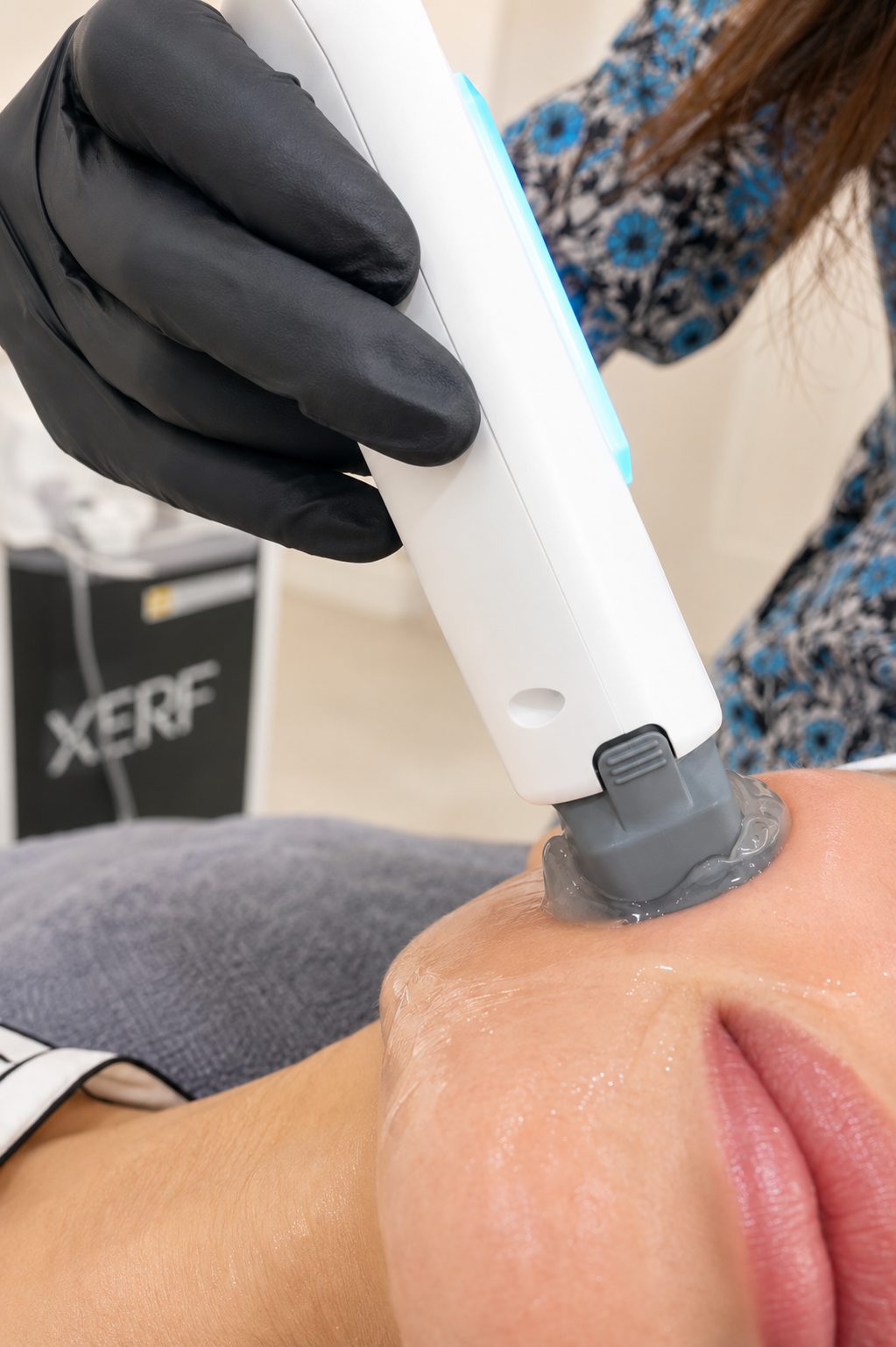 XERF radiofrequency skin tightening being administered at Elea Clinic Bali